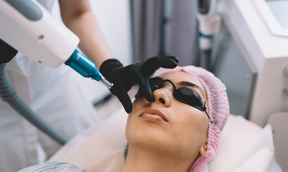 Types of Laser Treatments for Face