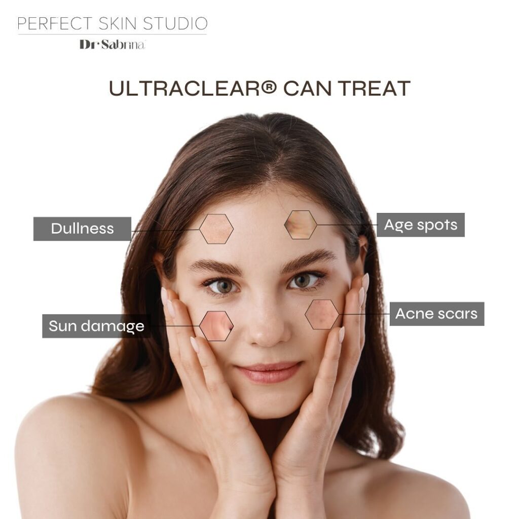 UltraClear Laser