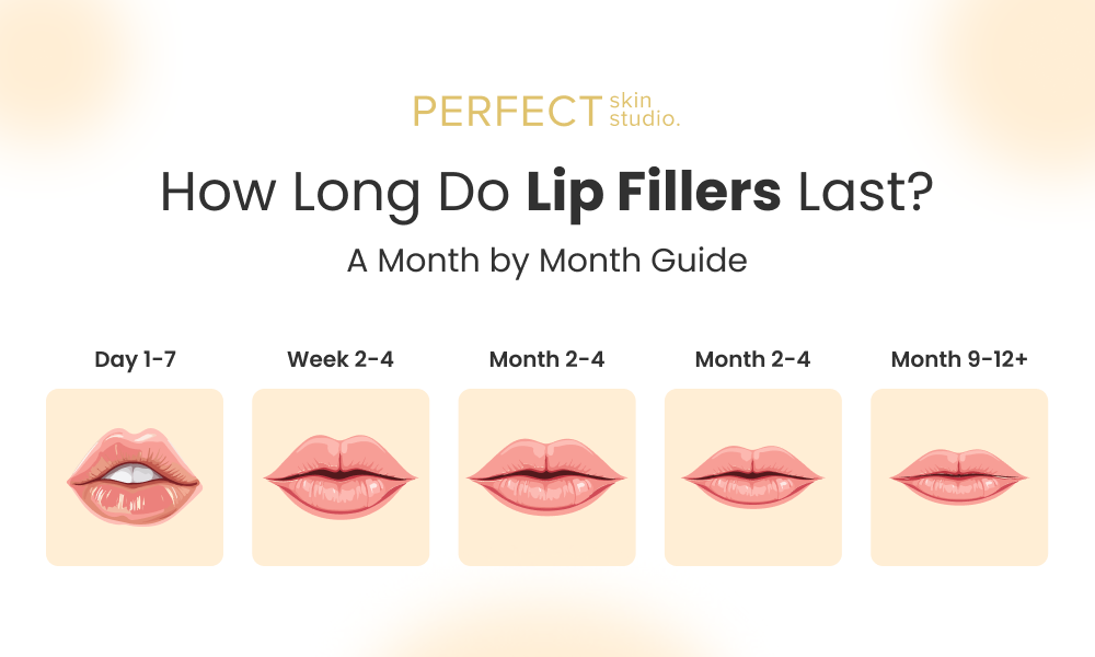 Lip_Filler