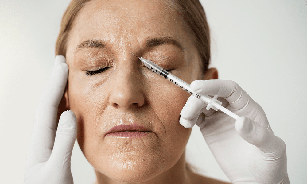 Best Deep Wrinkle Filler